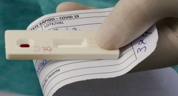 Goiás registra 160 casos e 8 óbitos por coronavírus neste domingo